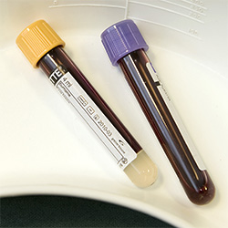 Blood vials Blood vials
