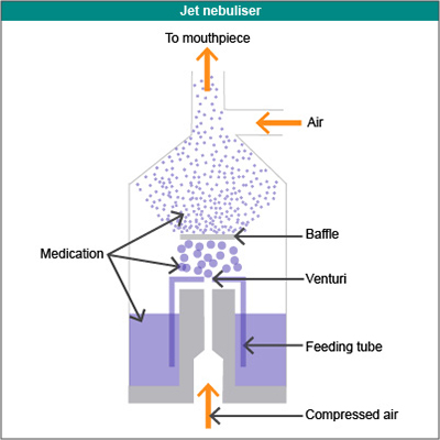 Jet nebuliser